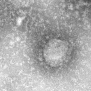 Health Reporter: Signs of the Times - What is a Virus? What is COVID-19?